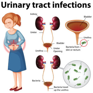 Urinary Tract Infection