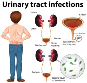 Urinary Tract Infection